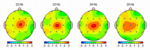 QEEG voor Neurofeedback